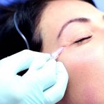 کربوکسی تراپی