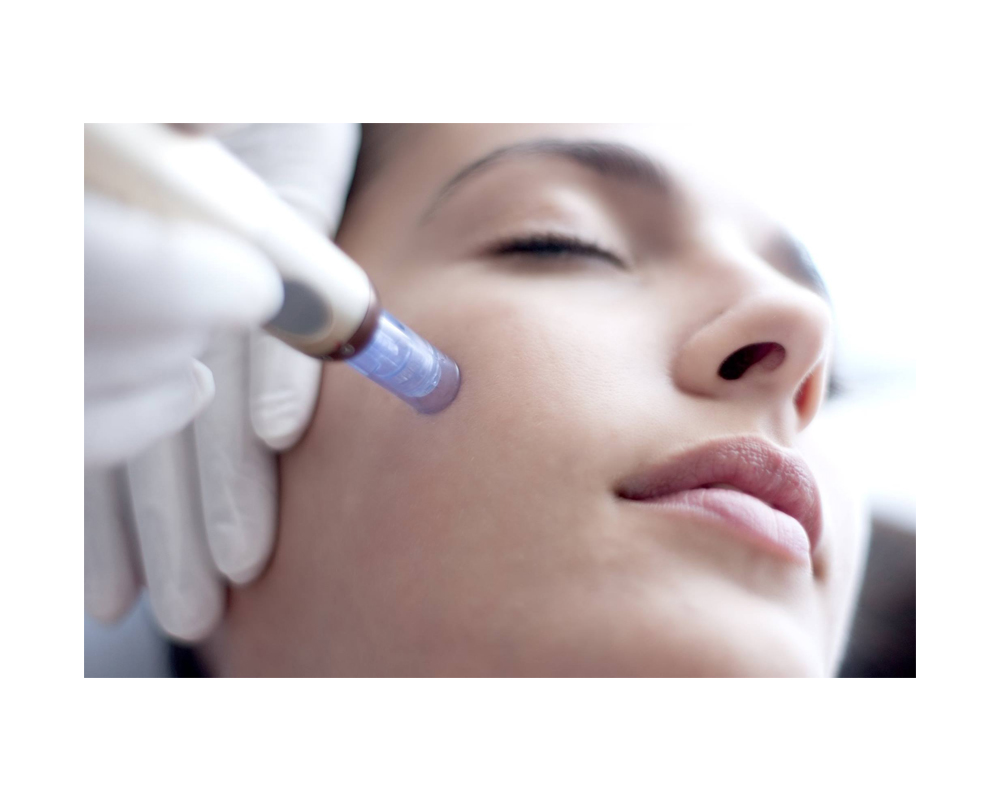 مزونیدلینگ