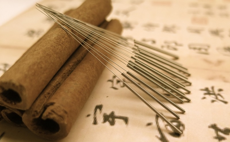 درمان بیماری قلبی با طب سوزنی