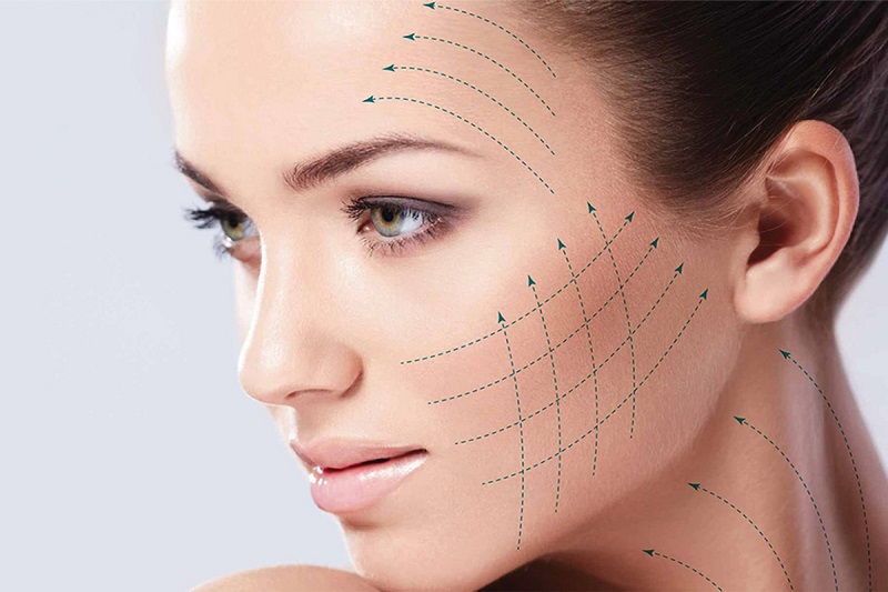 لیفتینگ با نخ