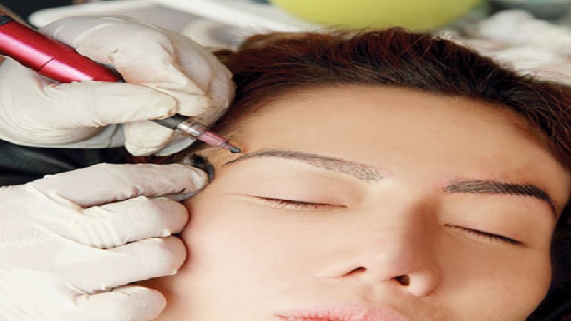 روش میکروپیگمنتیشن چیست؟