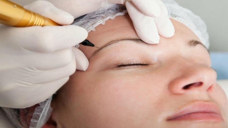 چه کسانی میکروپیگمنتیشن انجام می‌دهند؟