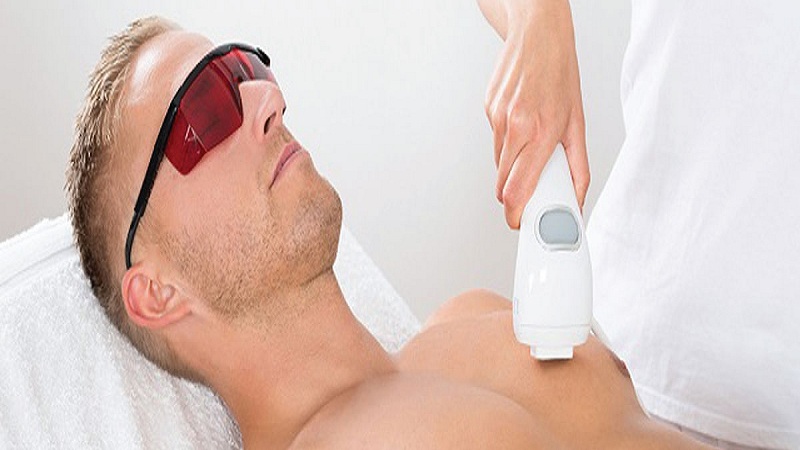 آمادگی قبل از لیزر موهای زائد بدن