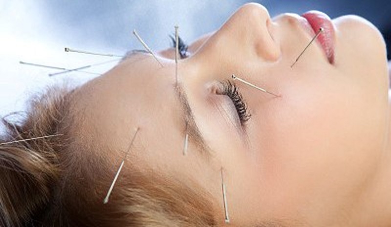 کاربرد طب سوزنی