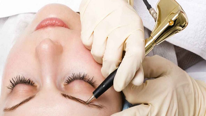 متخصص برای انجام میکروبلیدینگ ابرو اصفهان