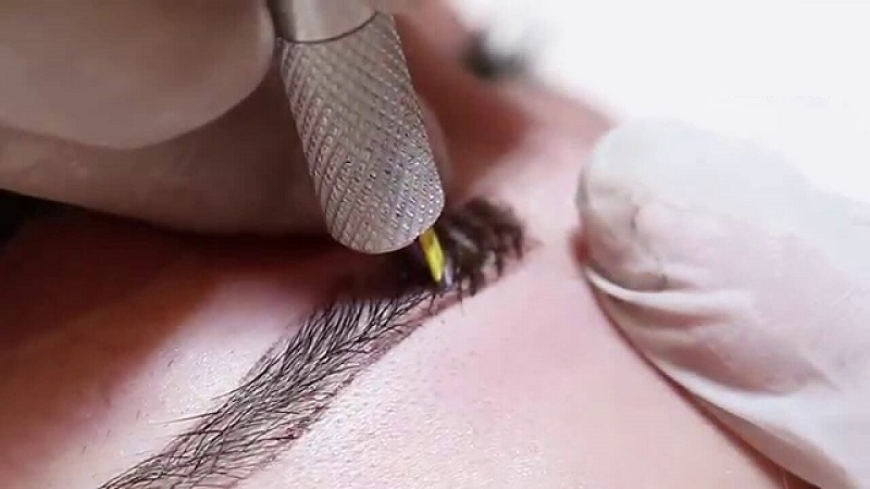 مراحل قبل از میکروبلیدینگ