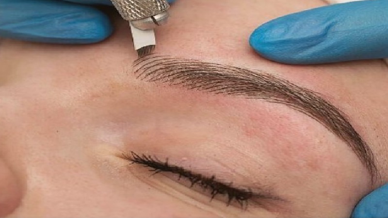 دستورالعمل مراقبتی بعد از انجام میکروبلیدینگ