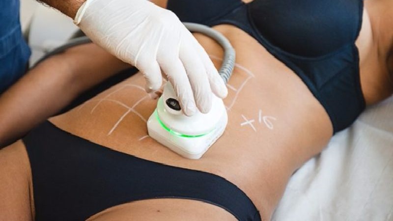 افراد مناسب استفاده از تکنولوژی هایفو لاغری