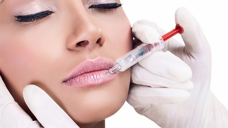 تزریق ژل لب با این 16 نکته مهم 