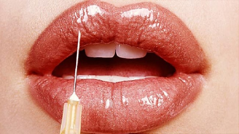 بهترین مطب زیبایی اصفهان 14 نکته قبل از تزریق ژل لب
