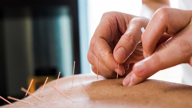 طب سوزنی اصفهان چطور متخصص طب سوزنی را انتخاب کنیم ؟