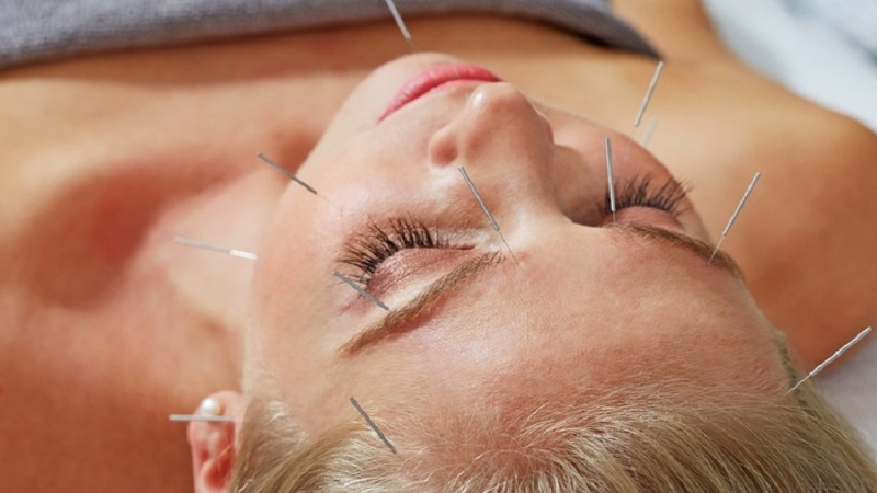 طب سوزنی اصفهان کاربردهای درمانی طب سوزنی