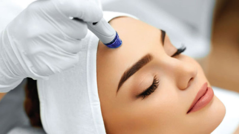 مطب زیبایی اصفهان مزایا و معایب برداشتن خال با لیزر