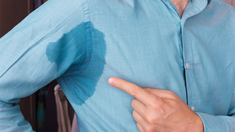 بهترین مطب زیبایی اصفهان هایپرهیدروزیس چیست؟