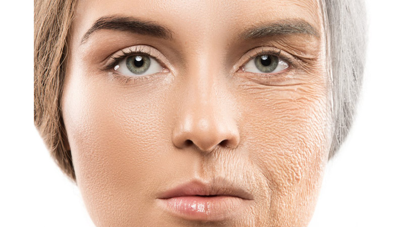 بهترین میکرودرم ابریژن اصفهان کلاژن