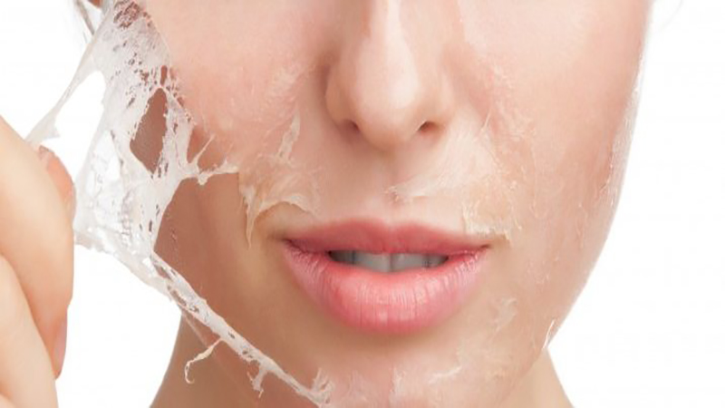بهترین مطب زیبایی اصفهان | پیلینگ شیمیایی