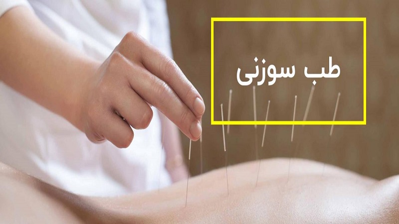 موارد درمان طب سوزنی-سازوکار این نوع درمان | بهترین مطب زیبایی اصفهان