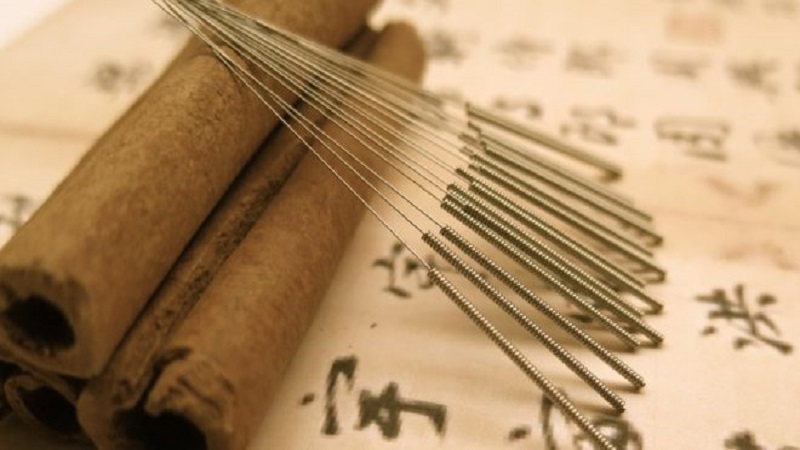 موارد درمان طب سوزنی-سازوکار این نوع درمان | بهترین مطب زیبایی اصفهان