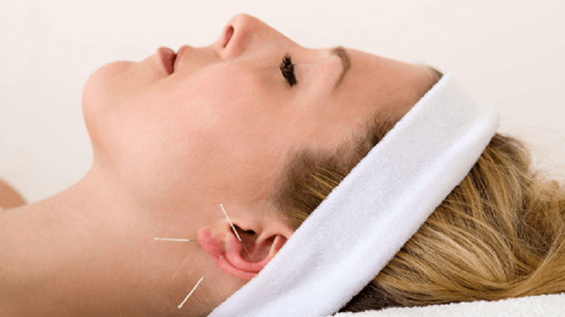 طب سوزنی در بیماری‌های زنان-موارد درمان | بهترین مطب زیبایی اصفهان