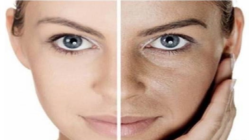 مزایا کربوکسی تراپی و عوارض جانبی آن چیست؟ | بهترین مطب زیبایی اصفهان