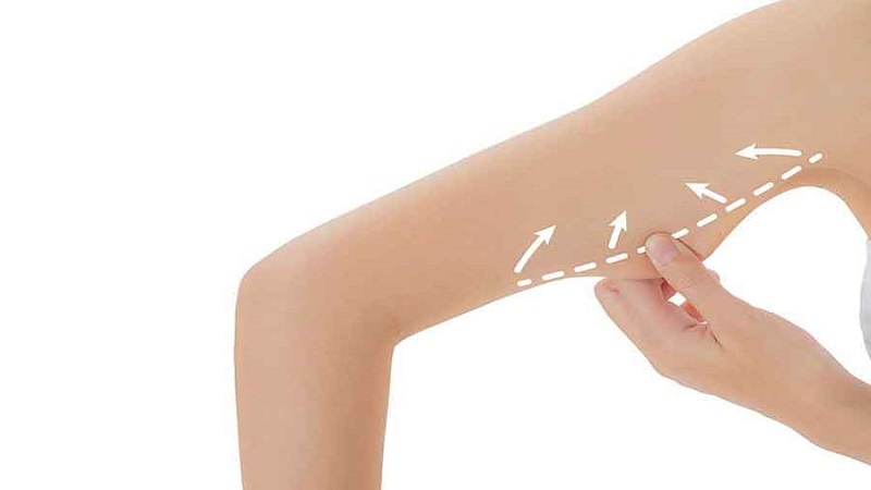 براکیوپلاستی چیست؟ | بهترین مطب زیبایی اصفهان