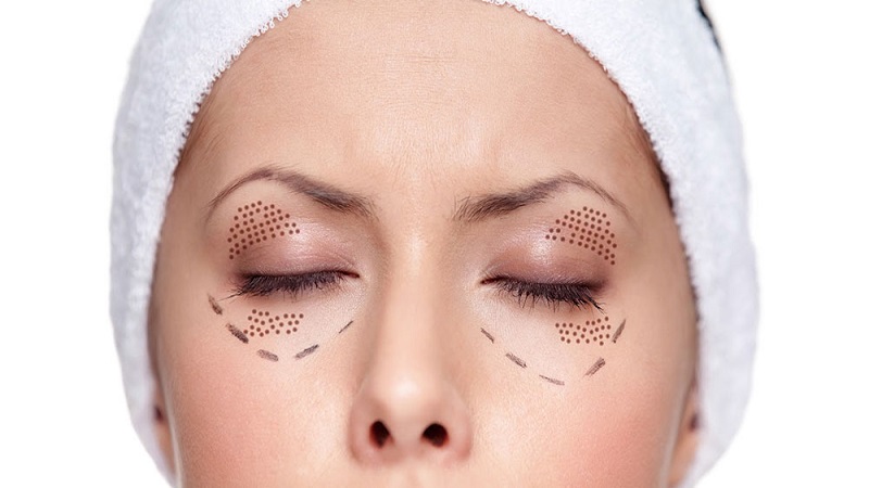 پلاسما جت چیست | بهترین مطب زیبایی اصفهان