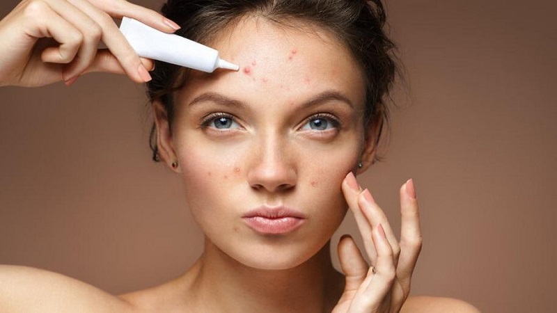 دلیل بروز جوش های زیر پوستی | بهترین مطب زیبایی اصفهان