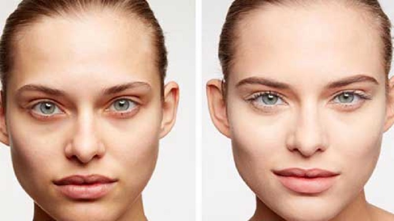 روش‌های خانگی درمان گودی چشم | بهترین مطب زیبایی اصفهان