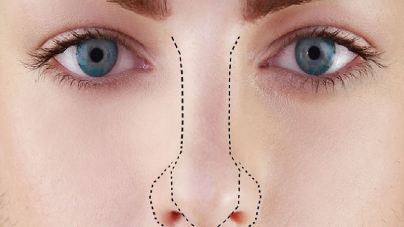 ماندگاری نتایج پلاسما جت دائمی است ؟ | بهترین مطب زیبایی اصفهان