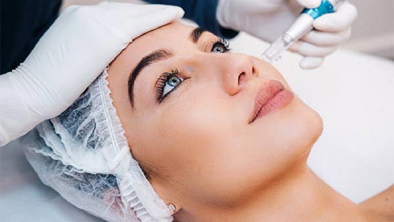 مزایا و نتایج مزونیدلینگ | بهترین مطب زیبایی اصفهان