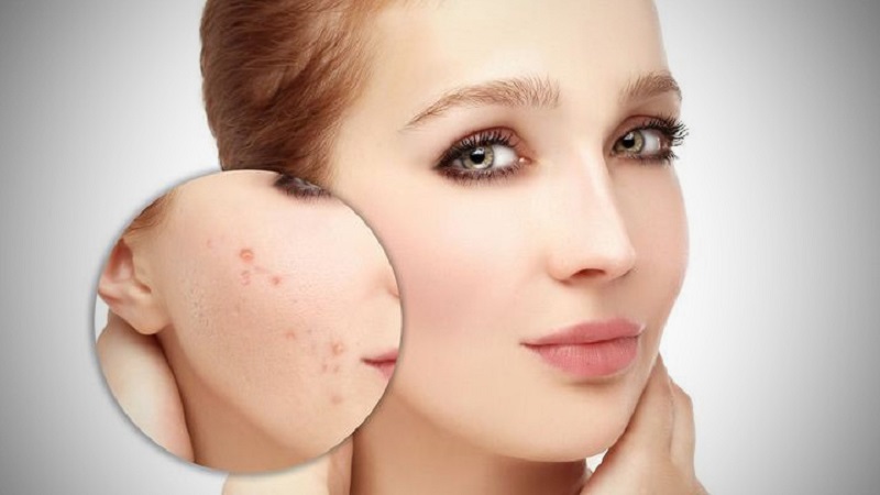 روش‌های درمان ضایعات رنگی پوست | بهترین مطب زیبایی اصفهان
