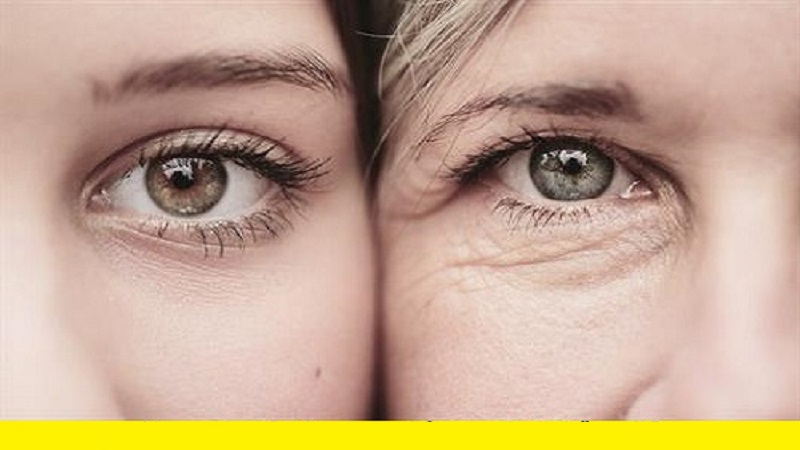 تزریق فیلر زیر چشم | بهترین مطب زیبایی اصفهان