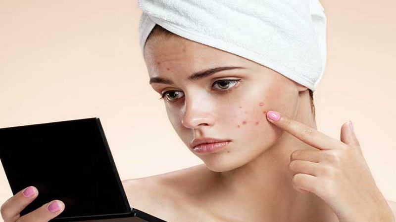 ضدلک گیاهی و درمان لک های پوست | بهترین مطب زیبایی اصفهان