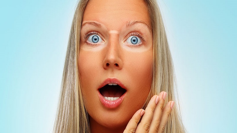 درمان تاول آفتاب سوختگی | بهترین مطب زیبایی اصفهان