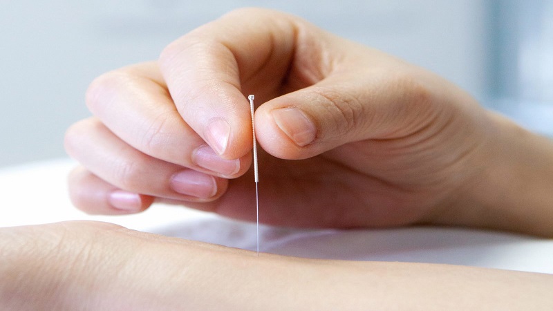 بهترین مطب زیبایی اصفهان | لاغری و کاهش وزن با طب سوزنی