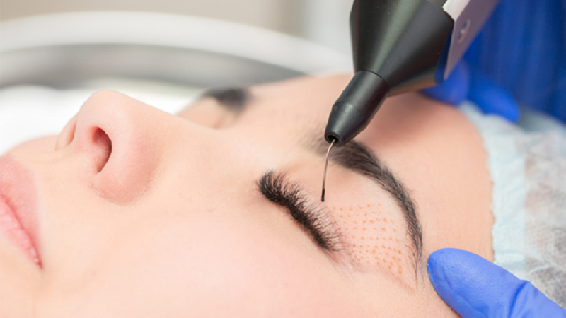 بهترین مطب زیبایی اصفهان | پلکسر یا پلاسما جت