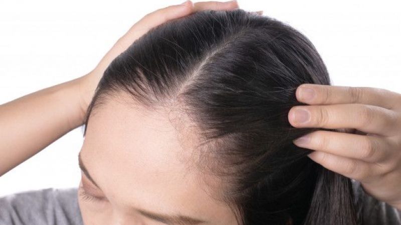 میکرو اسکالپ مناسب چه کسانی است؟ | بهترین مطب زیبایی اصفهان