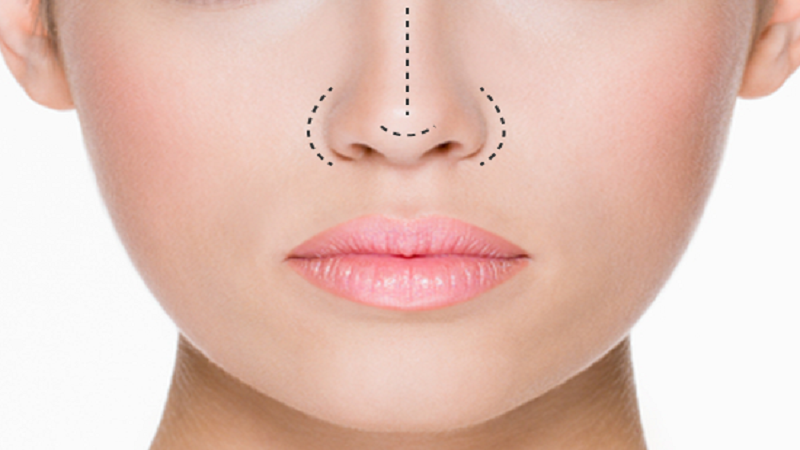 بهترین مطب زیبایی اصفهان | پلاسما جت بینی برای زیبایی بینی