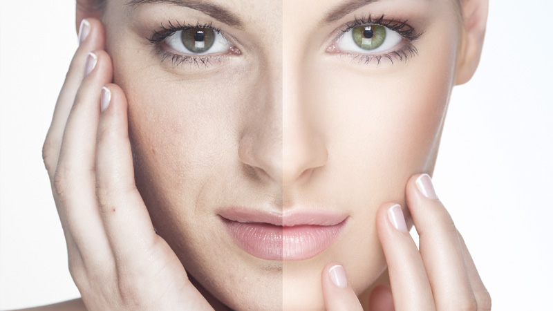 هدف از جوانسازی پوست صورت چیست؟ | بهترین مطب زیبایی اصفهان