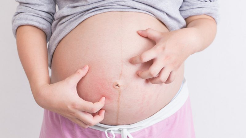 علل خشکی و خارش پوست در دوران بارداری | بهترین مطب زیبایی اصفهان