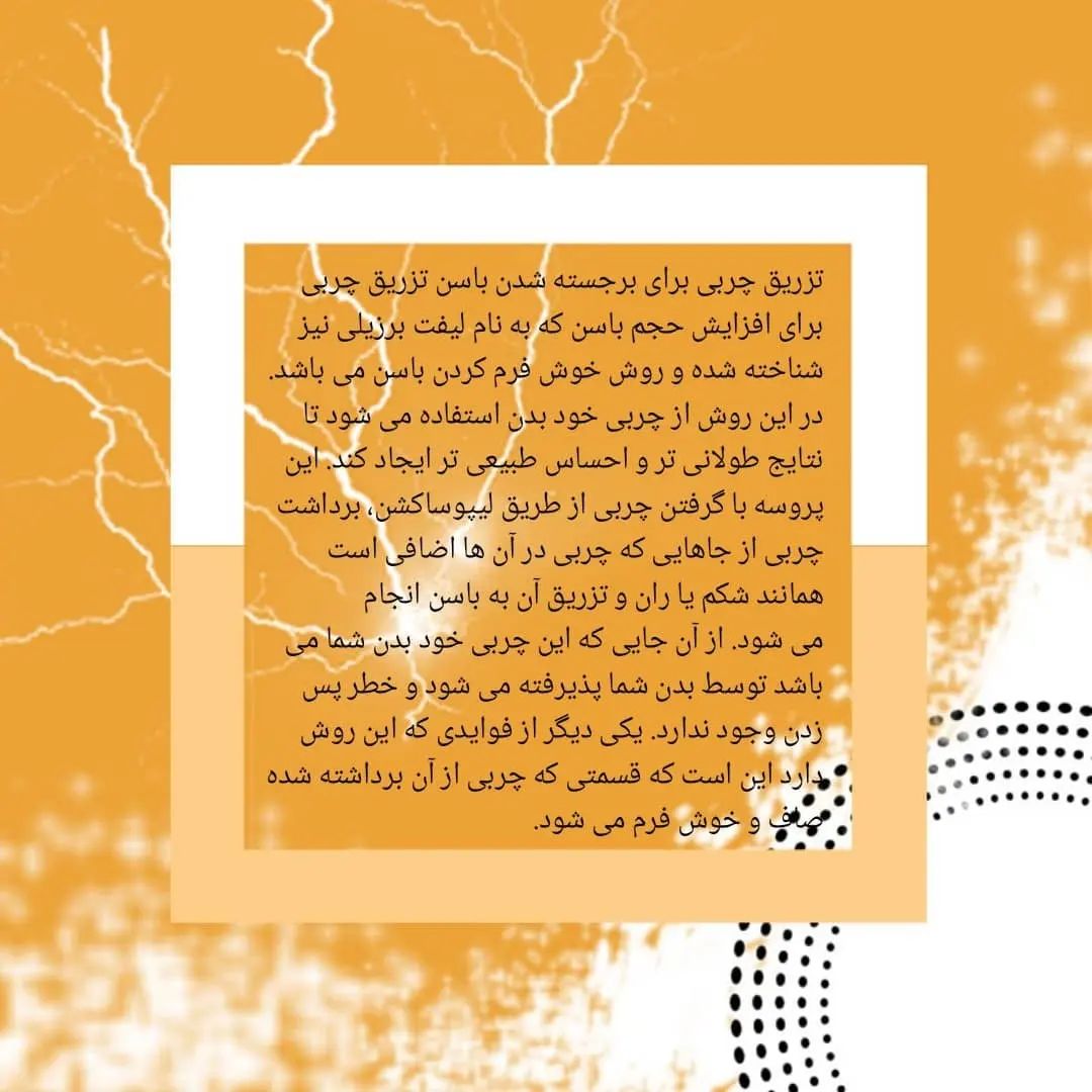 علل محبوبیت تزریق چربی | بهترین مطب زیبایی اصفهان