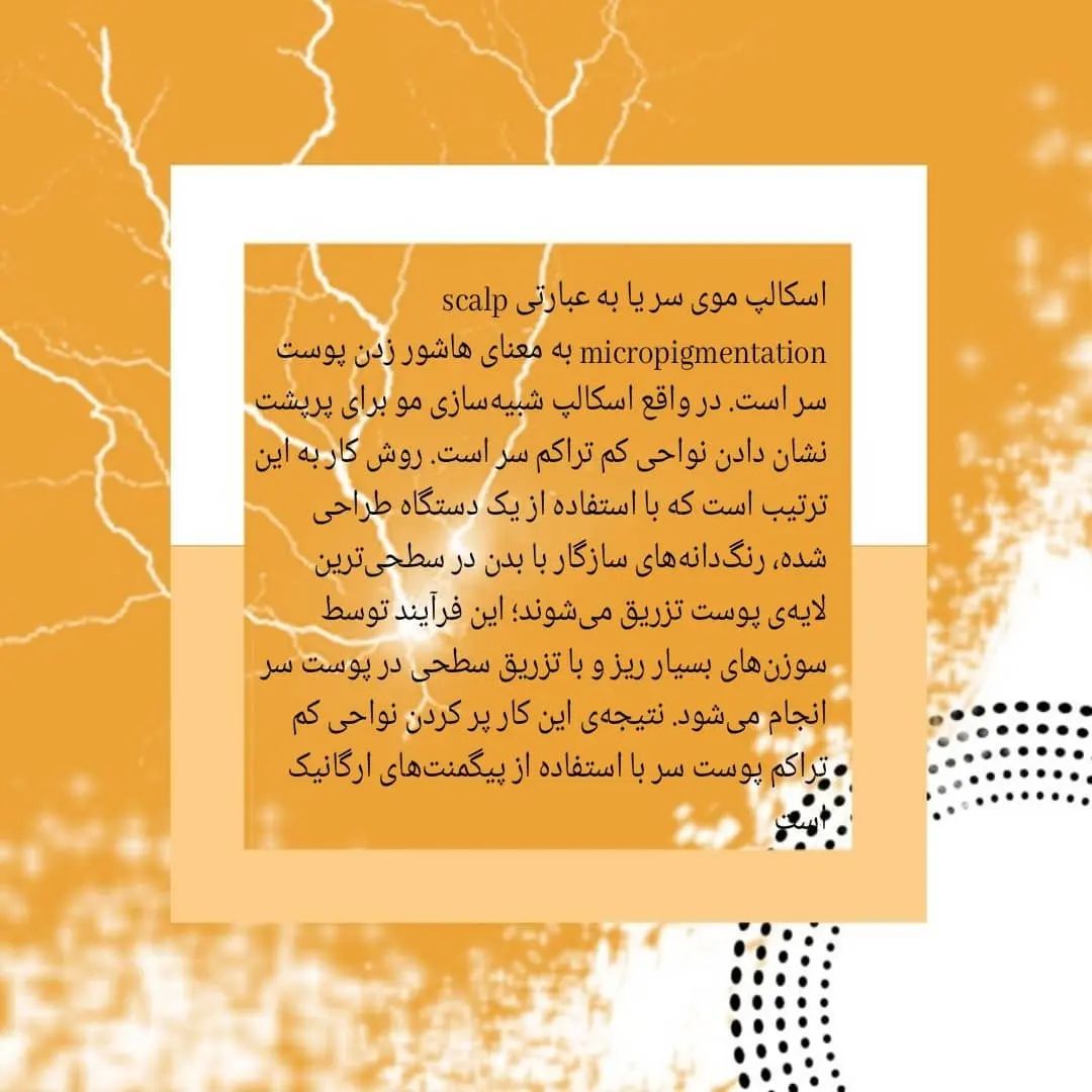 تکنیک اسکالپ موی سر | بهترین مطب زیبایی اصفهان