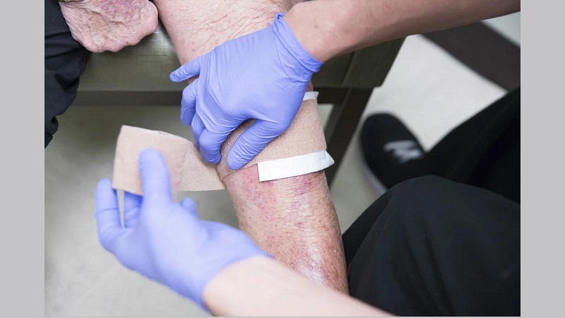 عوامل ایجاد و تشدید کننده زخم های مزمن | بهترین مطب زیبایی اصفهان