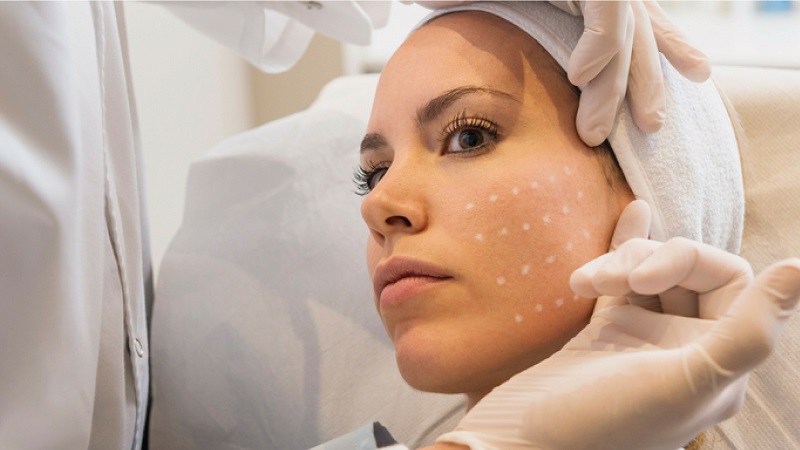 بررسی مزوتراپی صورت | بهترین مطب زیبایی اصفهان