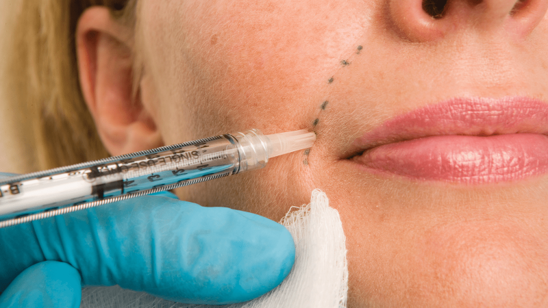 دوران نقاهت تزریق چربی به صورت | بهترین مطب زیبایی اصفهان