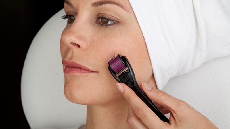 میکرونیدلینگ و لایه برداری بعد از بوتاکس | بهترین مطب زیبایی اصفهان