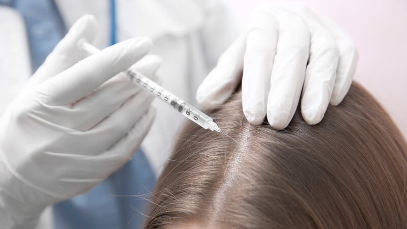 ویژگی افراد مناسب جهت انجام کربوکسی تراپی مو | بهترین مطب زیبایی اصفهان