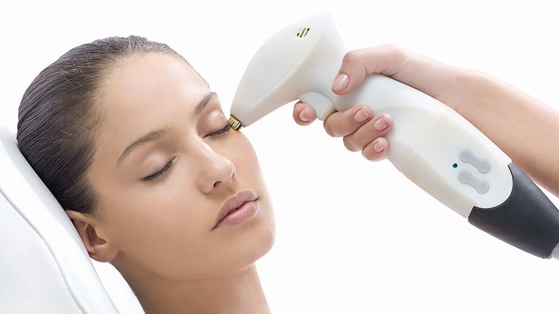 انواع دستگاه آر اف فرکشنال | تزریق ژل و بوتاکس اصفهان