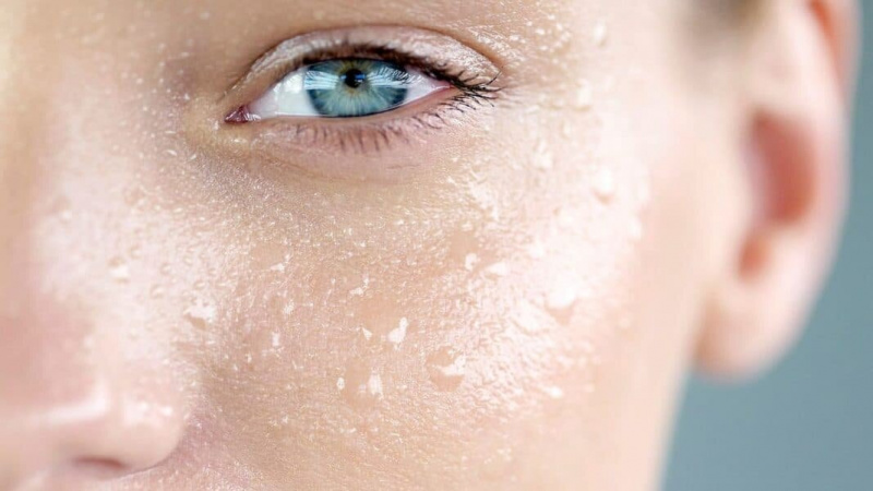 بررسی انواع پوست | تزریق ژل و بوتاکس اصفهان