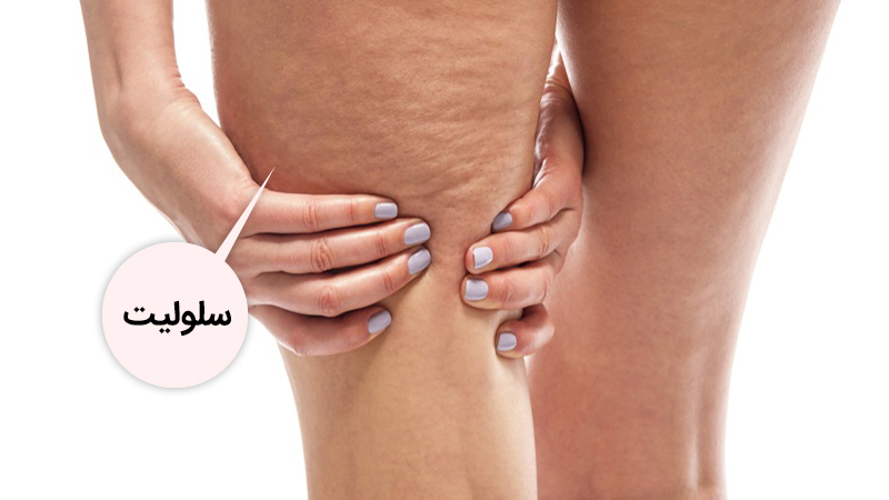 معرفی موارد فعال | تزریق ژل و بوتاکس اصفهان